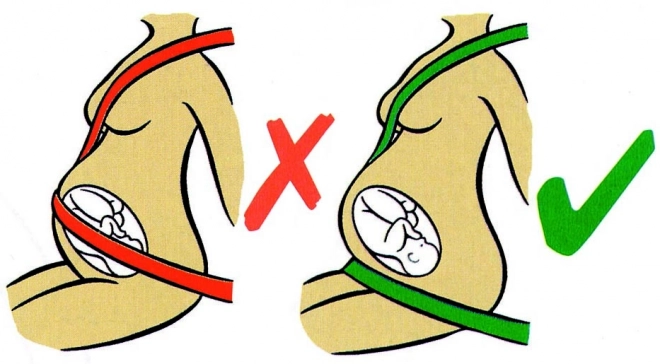 Ceinture de sécurité pour femmes enceintes